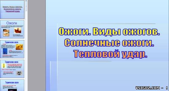Презентація на тему "Опіки"