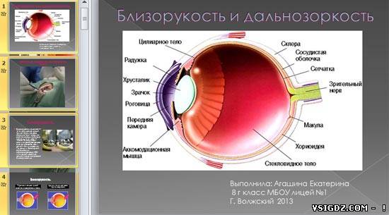 Презентація на тему "Короткозорість і далекозорість"